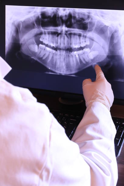 Best Dental Abscess Treatment in Bonanza, GA