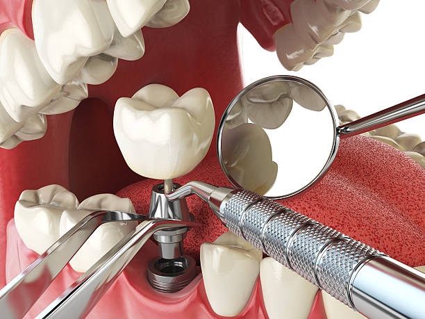 Best Emergency Orthodontic Repairs in Bonanza, GA